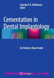 Cementation in Dental Implantology: An Evidence-Based Guide (pdf)